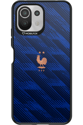Franta 2.0 2.0 - Xiaomi Mi 11 Lite (2021)