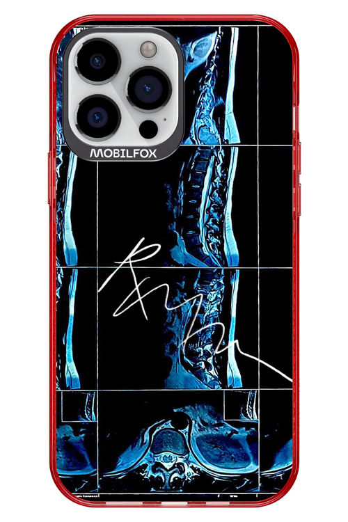 RMN Scolioza 2.0 - Apple iPhone 13 Pro Max