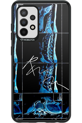 RMN Scolioza 2.0 - Samsung Galaxy A52 / A52 5G / A52s