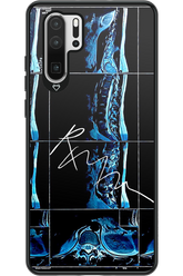 RMN Scolioza 2.0 - Huawei P30 Pro