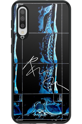 RMN Scolioza 2.0 - Samsung Galaxy A50