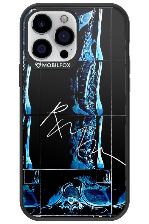 RMN Scolioza 2.0 - Apple iPhone 13 Pro Max
