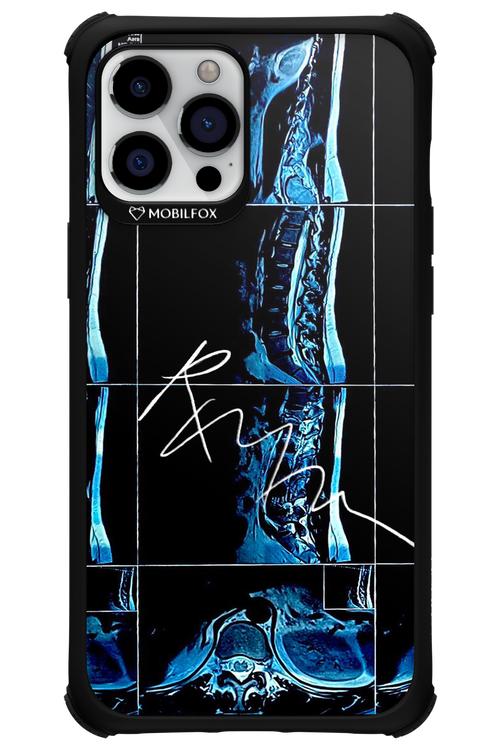 RMN Scolioza 2.0 - Apple iPhone 12 Pro Max