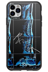 RMN Scolioza 2.0 - Apple iPhone 11 Pro Max