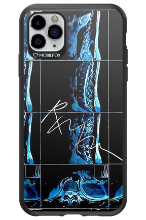 RMN Scolioza 2.0 - Apple iPhone 11 Pro Max