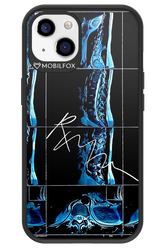 RMN Scolioza 2.0 - Apple iPhone 13