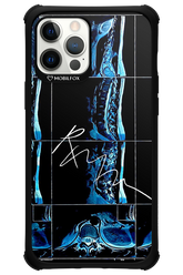 RMN Scolioza 2.0 - Apple iPhone 12 Pro Max