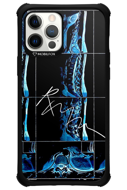 RMN Scolioza 2.0 - Apple iPhone 12 Pro Max