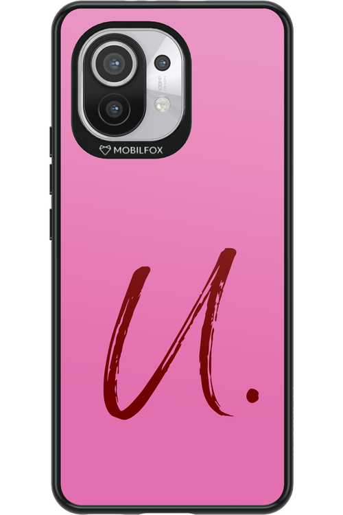 (Sorbet) U 2.0 - Xiaomi Mi 11 5G