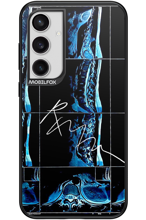 RMN Scolioza 2.0 - Samsung Galaxy S24+