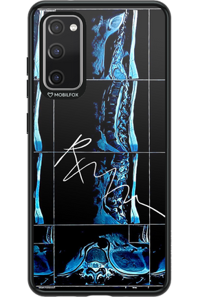 RMN Scolioza 2.0 - Samsung Galaxy S20 FE