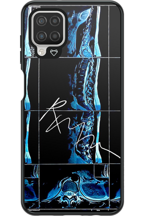 RMN Scolioza 2.0 - Samsung Galaxy A12