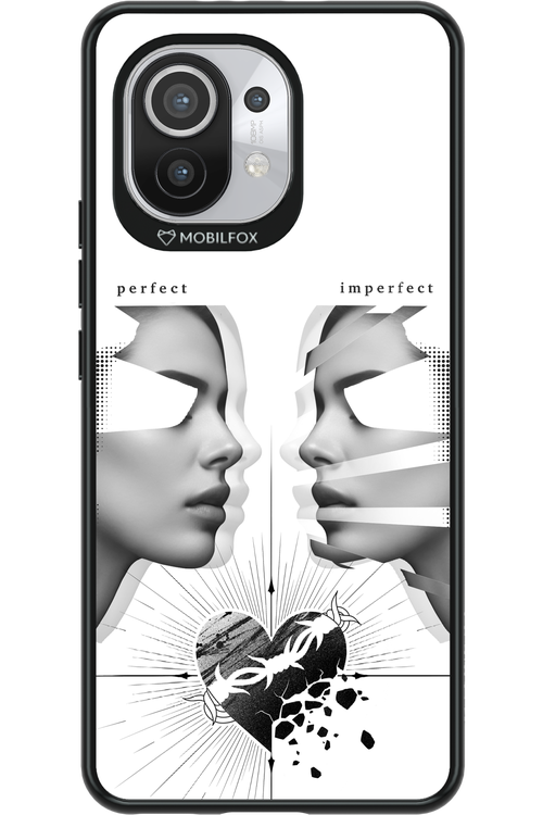 Arcok 2.0 - Xiaomi Mi 11 5G