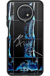 RMN Scolioza 2.0 - Xiaomi Redmi Note 9T 5G
