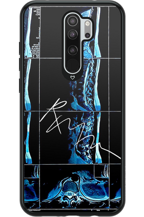 RMN Scolioza 2.0 - Xiaomi Redmi Note 8 Pro