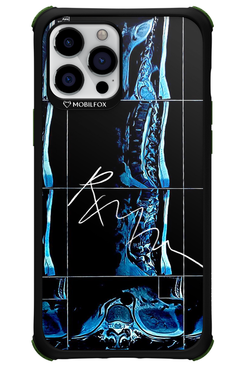 RMN Scolioza 2.0 - Apple iPhone 12 Pro Max