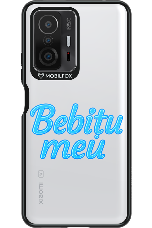 Meuu 2.0 - Xiaomi Mi 11T Pro
