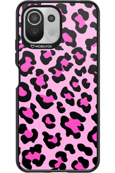 PINK LEOPARD - Xiaomi Mi 11 Lite (2021)