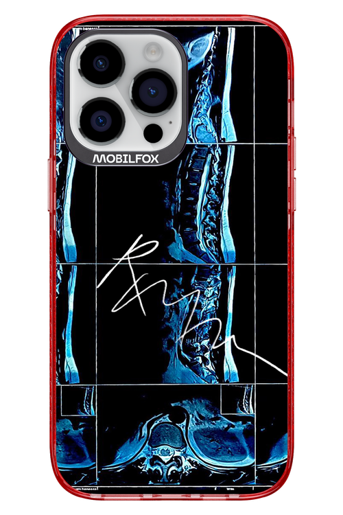 RMN Scolioza 2.0 - Apple iPhone 14 Pro Max
