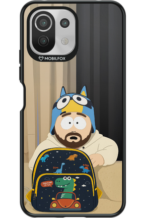 KidHeli - Xiaomi Mi 11 Lite (2021)