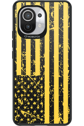 Crash & Stripes 2.0 - Xiaomi Mi 11 5G