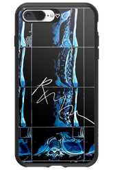 RMN Scolioza 2.0 - Apple iPhone 8 Plus