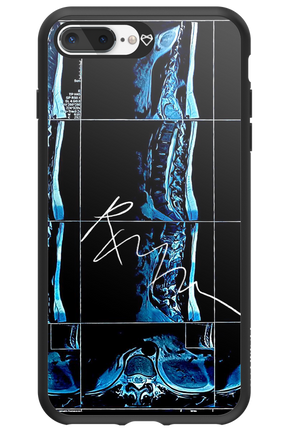 RMN Scolioza 2.0 - Apple iPhone 8 Plus