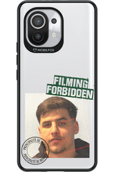 Sorin Mugshot - Xiaomi Mi 11 5G