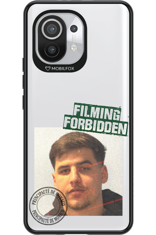 Sorin Mugshot - Xiaomi Mi 11 5G