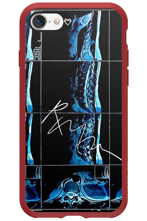 RMN Scolioza 2.0 - Apple iPhone SE 2020