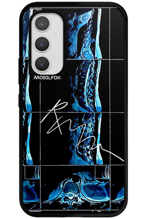 RMN Scolioza 2.0 - Samsung Galaxy A54