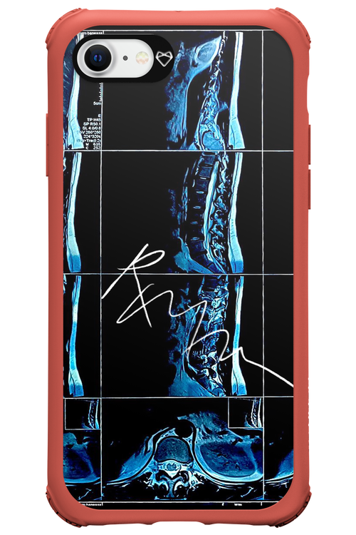 RMN Scolioza 2.0 - Apple iPhone SE 2020