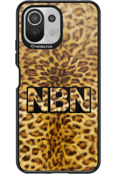 Cheetahh 2.0 - Xiaomi Mi 11 Lite (2021)