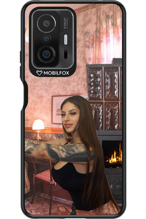 Tattooed Flame - Xiaomi Mi 11T