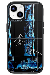 RMN Scolioza 2.0 - Apple iPhone 14