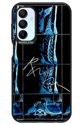 RMN Scolioza 2.0 - Samsung Galaxy A15