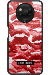 New Era 2.0 - Xiaomi Poco X3 Pro
