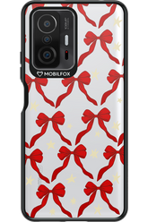 Bow & Stars (Transparent) - Xiaomi Mi 11T
