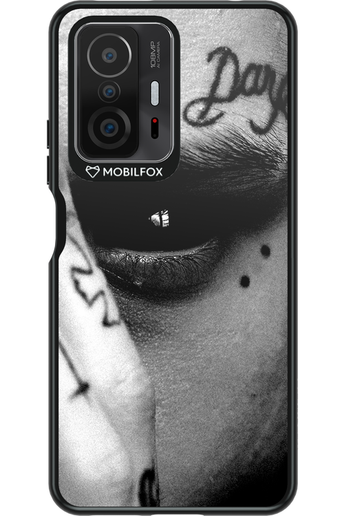 Eye On You - Xiaomi Mi 11T