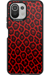 Deadly 2.0 - Xiaomi Mi 11 Lite (2021)