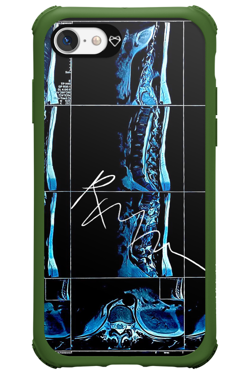 RMN Scolioza 2.0 - Apple iPhone 7