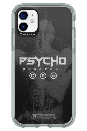 X-Ray - Apple iPhone 11