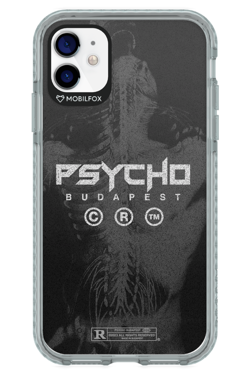 X-Ray - Apple iPhone 11