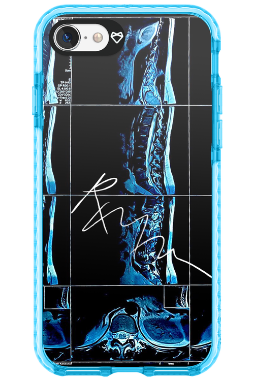 RMN Scolioza 2.0 - Apple iPhone 7