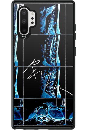 RMN Scolioza 2.0 - Samsung Galaxy Note 10+