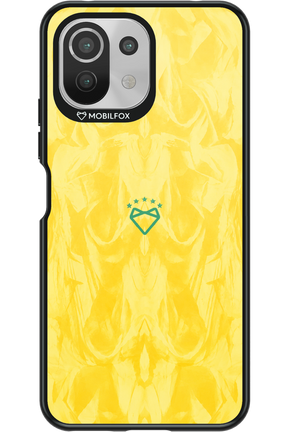 Brasil X Mobilfox 2.0 - Xiaomi Mi 11 Lite (2021)