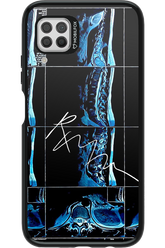 RMN Scolioza 2.0 - Huawei P40 Lite