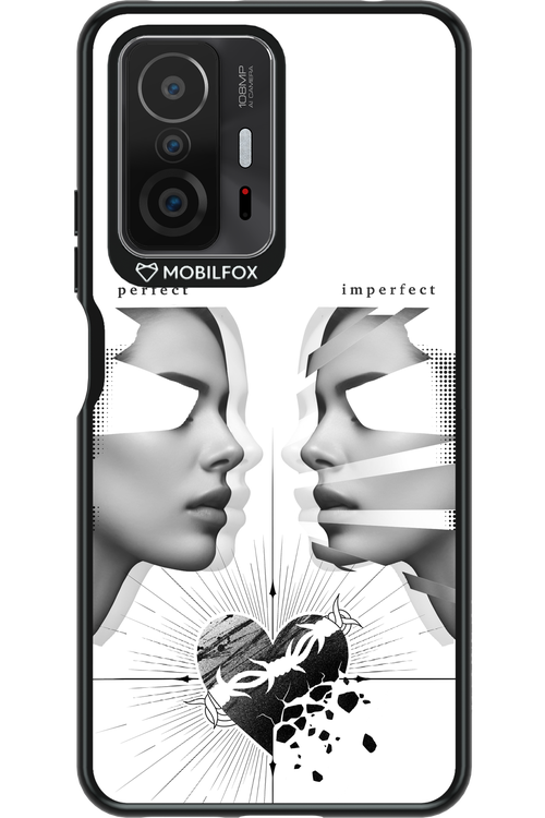 Arcok 2.0 - Xiaomi Mi 11T