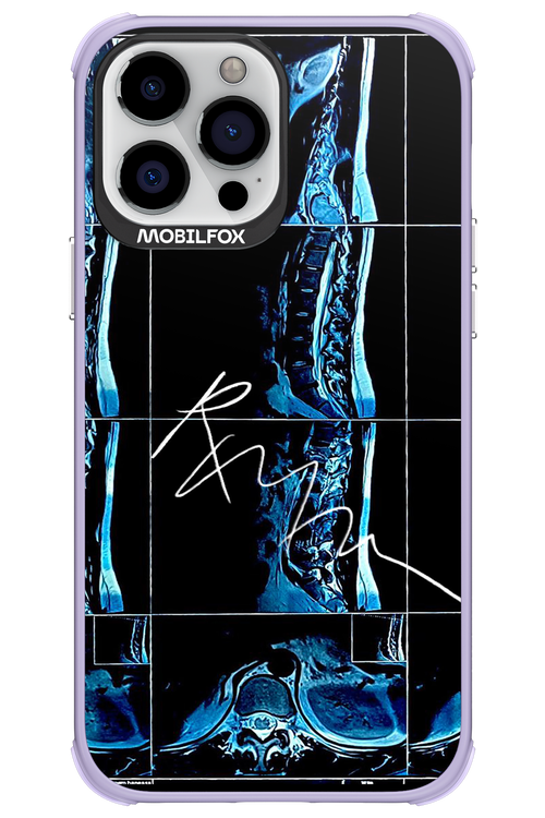 RMN Scolioza 2.0 - Apple iPhone 13 Pro Max
