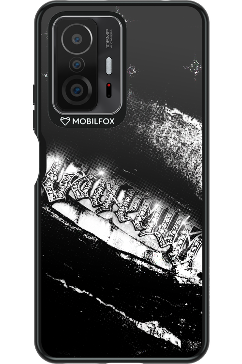 Grillz Black Centaur 2.0 - Xiaomi Mi 11T Pro